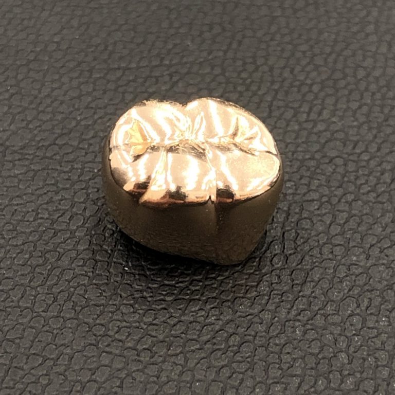金歯